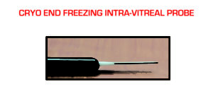 Cryo End Freezing Intra-Vitreal Probe