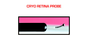Cryo Cataract Probe