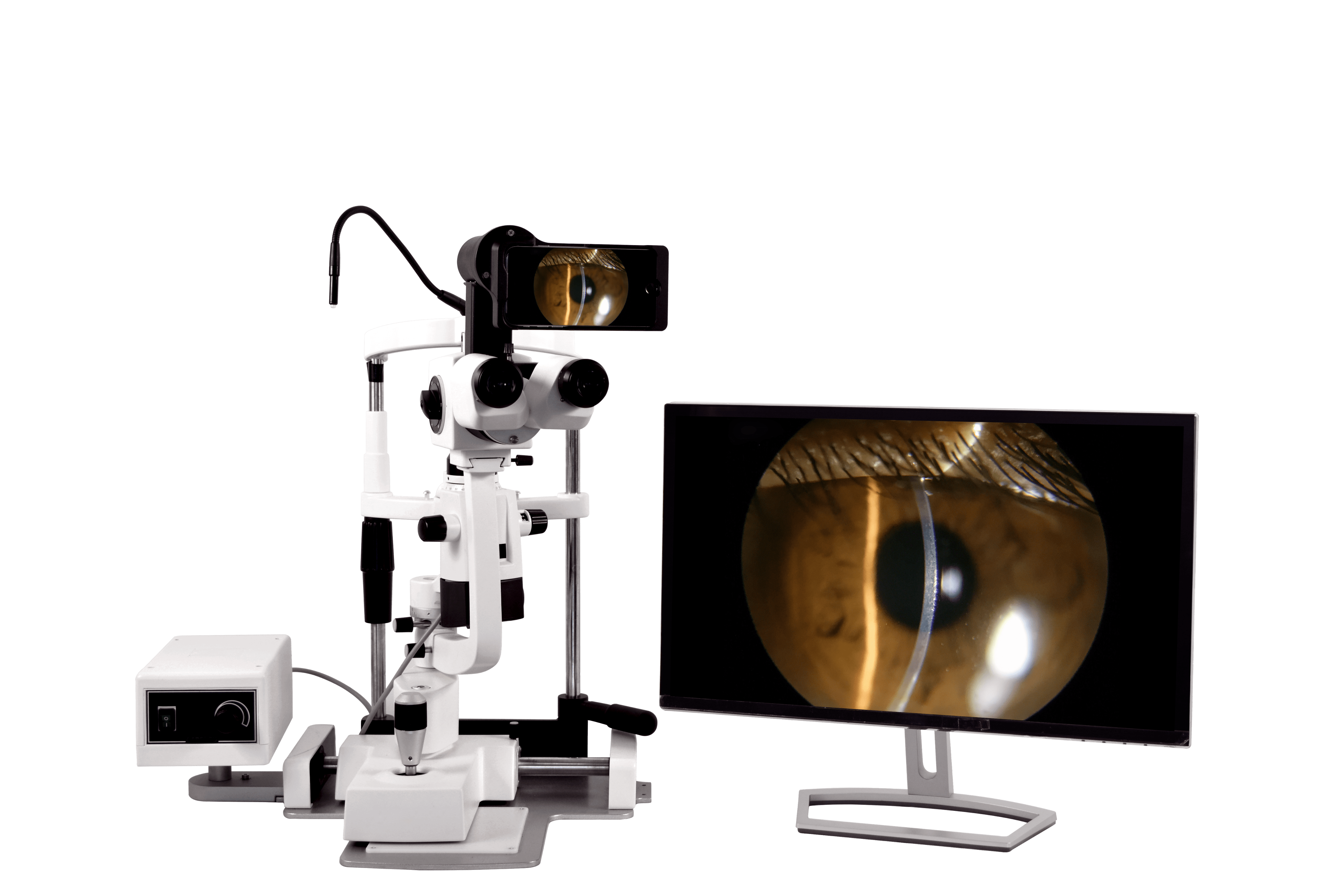 Anterior Imaging Module (AIM) - IAPB Valued Supplier Scheme